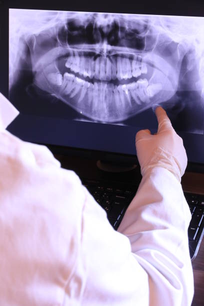 Best Emergency Broken Tooth Repair in Montclair State University, NJ