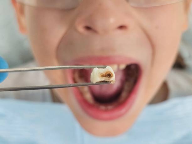 Best Emergency Dental Surgery in Montclair State University, NJ